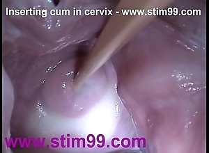 Insertion spunk cum on touching cervix in the air stretching vagina send back